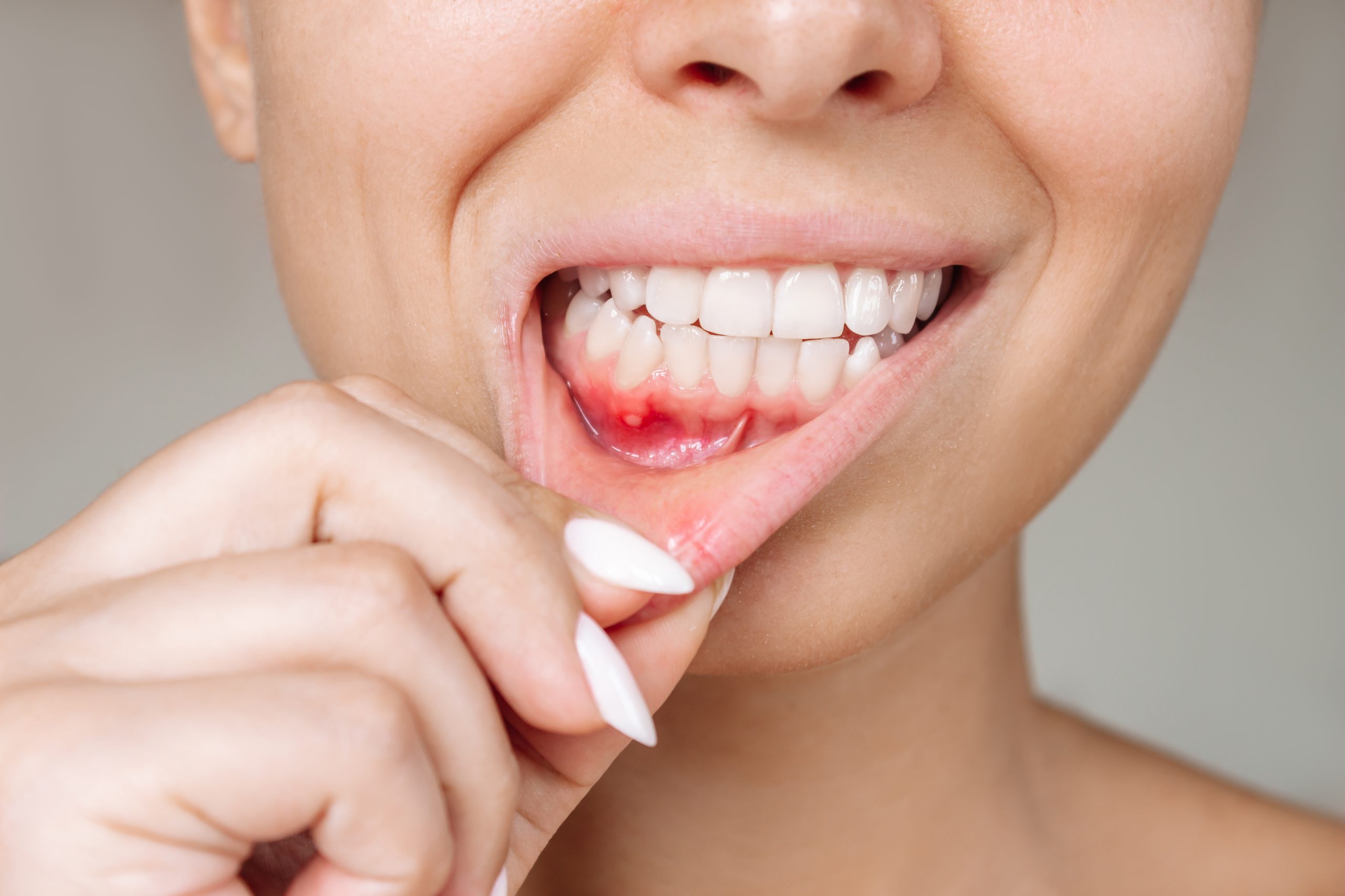 Gum Disease Treatment image