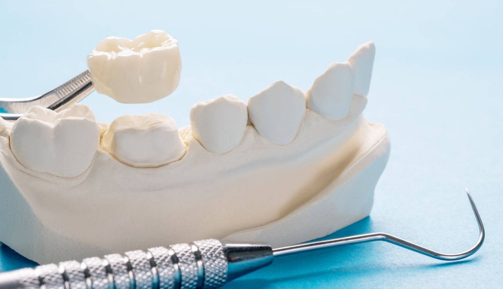 Different-Types-Of-Dental-Crowns-Advantages-Disadvantages